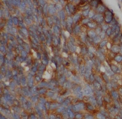 MENT Antibody - BSA Free