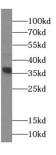 MENT Antibody - BSA Free