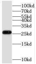 SELRC1 Antibody - BSA Free