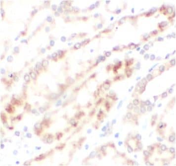 METTL18 Antibody - BSA Free