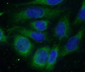 METTL18 Antibody - BSA Free