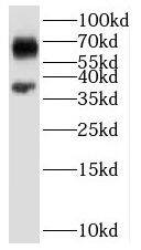 SARG Antibody - BSA Free