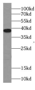 TMEM241 Antibody - BSA Free