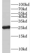 C18orf21 Antibody - BSA Free