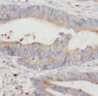 C18orf21 Antibody - BSA Free