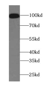 C15orf39 Antibody - BSA Free