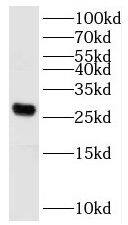 KATNBL1 Antibody - BSA Free