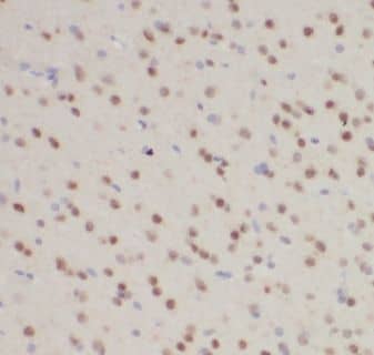 KATNBL1 Antibody - BSA Free