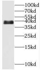 C14orf28 Antibody - BSA Free