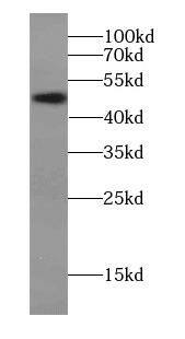 METTL21D Antibody - BSA Free