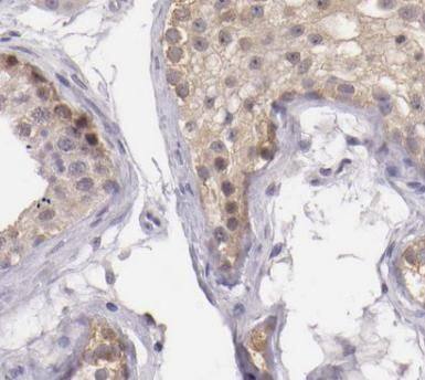 METTL21D Antibody - BSA Free