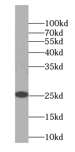 SMCO3 Antibody - BSA Free