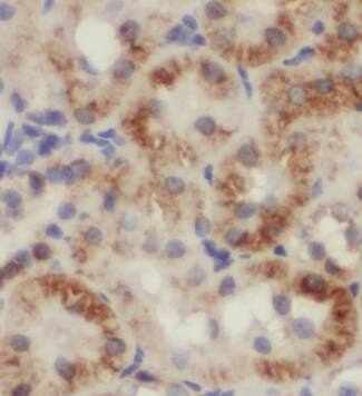 UQCC3 Antibody - BSA Free