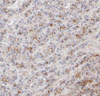 IFTAP Antibody - BSA Free