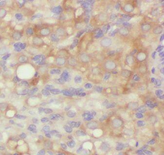 AAMDC Antibody - BSA Free