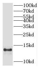 AAMDC Antibody - BSA Free