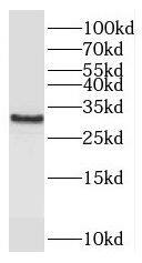 C11orf49 Antibody - BSA Free