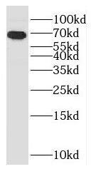CCDC7 Antibody - BSA Free