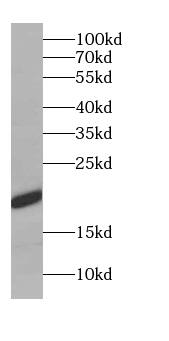 C10orf67 Antibody - BSA Free