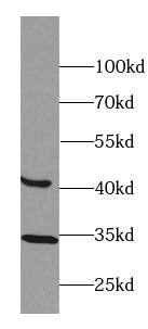 BTBD8 Antibody - BSA Free