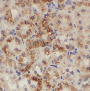 BTBD16 Antibody - BSA Free