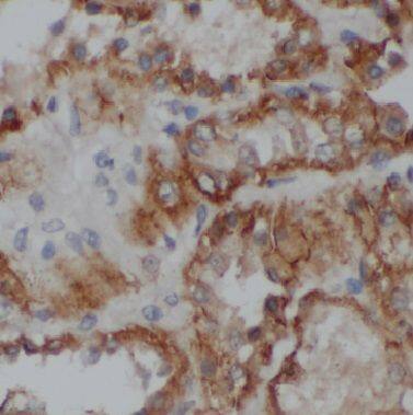 BRUNOL6 Antibody - BSA Free