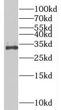BIVM Antibody - BSA Free