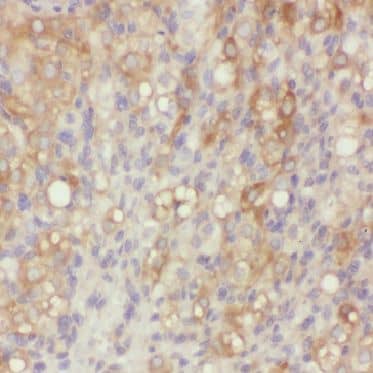 BIVM Antibody - BSA Free