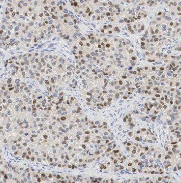 BEX2 Antibody - BSA Free