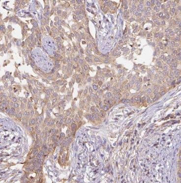 BET1L Antibody - BSA Free