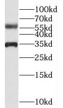 CCDC4 Antibody - BSA Free