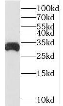 BDH1 Antibody - BSA Free