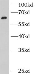 BCMO1 Antibody - BSA Free