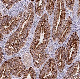 BCL7B Antibody - BSA Free