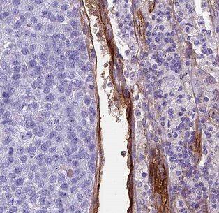 Bcl rambo Antibody - BSA Free
