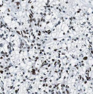 BCKDHB Antibody - BSA Free