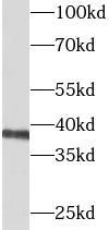 BCAT2 Antibody - BSA Free
