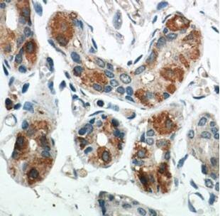 BCAT2 Antibody - BSA Free