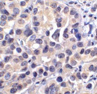 BCAT1 Antibody - BSA Free