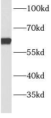 BBS9 Antibody - BSA Free