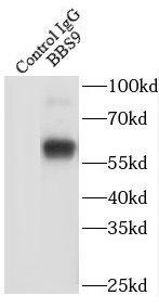 BBS9 Antibody - BSA Free