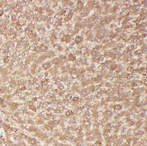 BBS9 Antibody - BSA Free