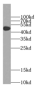 TTC8 Antibody - BSA Free