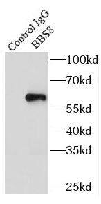 TTC8 Antibody - BSA Free