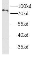 BBS10 Antibody - BSA Free