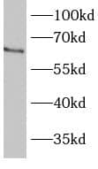 BBS1 Antibody - BSA Free