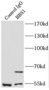 BBS1 Antibody - BSA Free