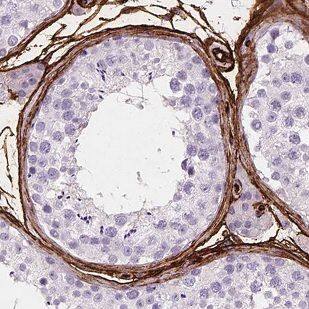 BARHL2 Antibody - BSA Free