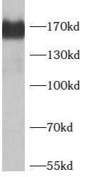 SMARCC2/BAF170 Antibody - BSA Free