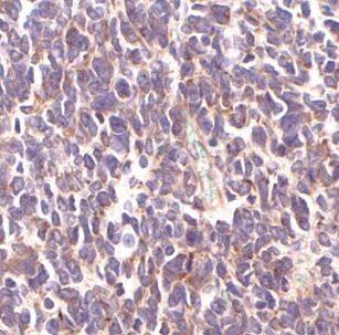 SMARCC2/BAF170 Antibody - BSA Free